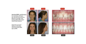 Patient-Before-After-Results