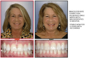 Linda-Frost-Before-After-Slide