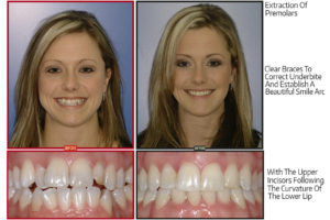 Randi-Before-After-Slide