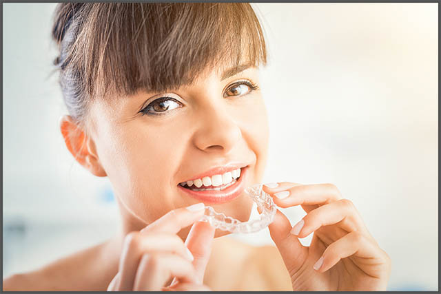 Clear-Aligners Example