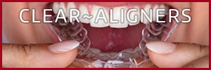 Invisalign® The Clear alternative to braces